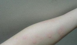 过敏可以吃南长瓜,南长瓜的神奇功效与食用指南